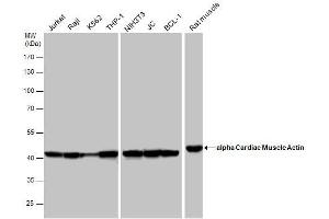 Western Blotting (WB) image for anti-Actin, Alpha, Cardiac Muscle 1 (ACTC1) antibody (ABIN2855212)