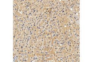 anti-ATP-Binding Cassette, Sub-Family B (MDR/TAP), Member 4 (ABCB4) (AA 601-720) antibody