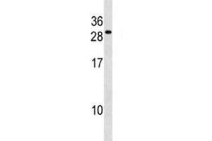 FADD antibody western blot analysis in WiDr lysate