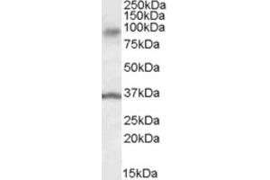 Western Blotting (WB) image for anti-Ankyrin Repeat and Protein Kinase Domain-Containing Protein 1 (ANKK1) (Internal Region) antibody (ABIN2466791)