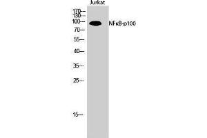 Western Blotting (WB) image for anti-Nuclear Factor of kappa Light Polypeptide Gene Enhancer in B-Cells 2 (NFKB2) (Thr160) antibody (ABIN3180753) (NFKB2 抗体  (Thr160))