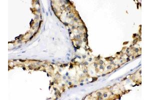 IHC analysis of Hsp90 alpha using anti-Hsp90 alpha antibody (ABIN3043848).