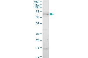 Western Blotting (WB) image for anti-Cytochrome P450, Family 7, Subfamily B, Polypeptide 1 (CYP7B1) (AA 203-286) antibody (ABIN564063)