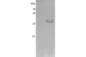 Western Blotting (WB) image for Interleukin 1, beta (IL1B) (AA 115-267) protein (His tag) (ABIN7123535) (IL-1 beta Protein (AA 115-267) (His tag))
