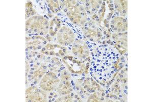 Immunohistochemistry of paraffin-embedded mouse kidney using CGB7 antibody (ABIN5974696) at dilution of 1/100 (40x lens). (CGB7 抗体)