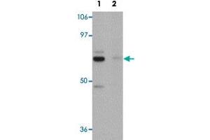 Western blot analysis of rat brain tissue with PIAS4 polyclonal antibody  at 1 ug/mL in (Lane 1) the absence and (Lane 2) the presence of blocking peptide .