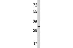 Western blot analysis of MARCKS antibody and HeLa lysate. (MARCKS 抗体  (AA 241-271))