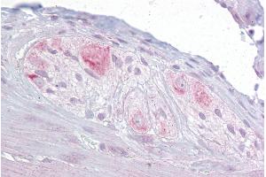 Immunohistochemistry (IHC) image for anti-RNA Binding Motif, Single Stranded Interacting Protein 3 (RBMS3) (Middle Region) antibody (ABIN2778689)