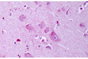 Anti-GABRB1 antibody IHC staining of human brain, cortex neurons. (GABRA1 抗体  (AA 327-450))
