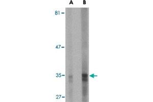 Western blot analysis of ENDOG expression in HepG2 cell lysate with ENDOG monoclonal antibody, clone 7G1G10  at (A) 5 and (B) 10 ug/mL . (Endonuclease G 抗体  (AA 76-170))
