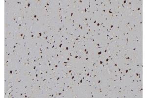ABIN6264280 and ABIN6276989 at 1/100 staining Human heart tissue by IHC-P.