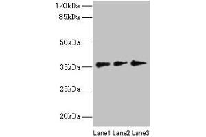 Western blot All lanes: LDAH antibody at 8 μg/mL Lane 1: Hela whole cell lysate Lane 2: Jurkat whole cell lysate Lane 3: A431 whole cell lysate Secondary Goat polyclonal to rabbit IgG at 1/10000 dilution Predicted band size: 38, 33, 23 kDa Observed band size: 38 kDa (LDAH/C2orf43 抗体  (AA 1-325))