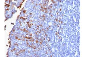 Formalin-fixed, paraffin-embedded human Tonsil stained with IgG Rabbit Recombinant Monoclonal Antibody (IG1707R). (Recombinant IGHG 抗体)