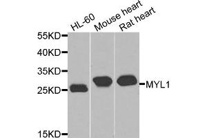 Western blot analysis of extracts of various cells, using MYL1 antibody. (MYL1 抗体)