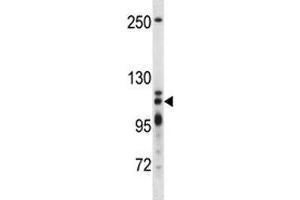 XRN2 antibody western blot analysis in T47D lysate (XRN2 抗体  (AA 48-76))