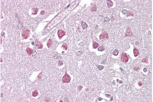 Immunohistochemistry with Brain, cortex tissue at an antibody concentration of 5µg/ml using anti-ETV1 antibody (ARP38528_P050) (ETV1 抗体  (Middle Region))