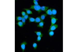 IF analysis of DIAPH1 using anti-DIAPH1 antibody (ABIN7599652). (DIAPH1 抗体  (AA 1039-1153))