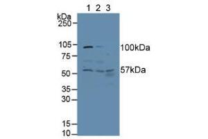 Western blot analysis of (1) Human HeLa cells, (2) Human A431 Cells and (3) Human Liver Tissue. (ALT 抗体  (AA 255-496))