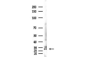 anti-Histone H1.3 (HIST1H1D) antibody