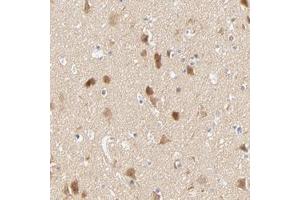 Immunohistochemical staining of human cerebral cortex with SULT4A1 polyclonal antibody  shows moderate cytoplasmic positivity in neuronal cells. (SULT4A1 抗体)