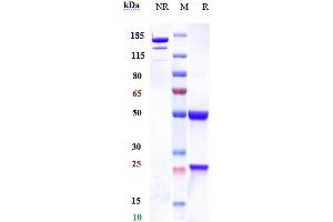Anti-CD46 Reference Antibody (FOR46) on SDS-PAGE under reducing (R) condition.
