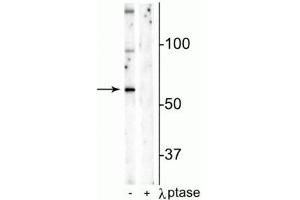 Western blot of mouse hippocampal lysate showing specific immunolabeling of the ~65 kDa Munc18-1 protein phosphorylated at Ser241 in the first lane (-). (STXBP1 抗体  (pSer241))