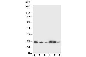 Western blot testing of SSR3 antibody and Lane 1:  rat liver (SSR3 抗体  (AA 8-23))