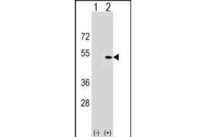 Western blot analysis of PLEKHA1 (arrow) using rabbit polyclonal PLEKHA1 Antibody (Center) (ABIN1537877 and ABIN2849727). (PLEKHA1 抗体  (AA 149-178))