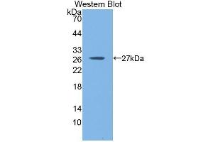 Western Blotting (WB) image for anti-Glutathione S-Transferase mu 1 (GSTM1) (AA 1-218) antibody (ABIN1078083) (GSTM1 抗体  (AA 1-218))