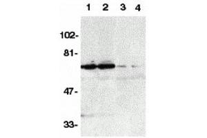 Western Blotting (WB) image for anti-Tumor Necrosis Factor Receptor Superfamily, Member 21 (TNFRSF21) antibody (ABIN1031729) (TNFRSF21 抗体)