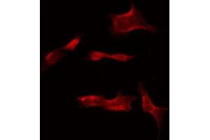 ABIN6275308 staining COLO205 by IF/ICC. (NSG1 抗体  (Internal Region))