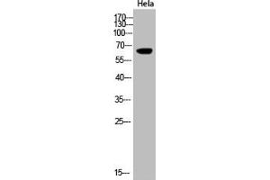 Western Blot analysis of Hela cells using Acetyl-Cytokeratin-pan (K194) Polyclonal Antibody (KRT2/KRT76/KRT3/KRT5/KRT6A/KRT6B/KRT6C/KRT71/KRT72/KRT73/KRT74/KRT75/KRT79/KRT7/KRT8/KRT84 (acLys194) 抗体)
