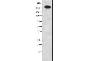 Western blot analysis of ZNF462 using HeLa whole cell lysates (ZNF462 抗体)