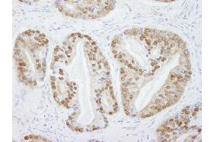 anti-Protein Arginine Methyltransferase 5 (PRMT5) (C-Term) antibody