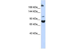 WB Suggested Anti-FBXO11 Antibody Titration:  0.