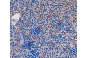 Used in DAB staining on fromalin fixed paraffin-embedded Kidney tissue (CD166 抗体  (AA 28-527))