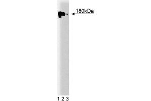 Western blot analysis of EFG-R on A431 cell lysate. (EGFR 抗体  (AA 1020-1046))