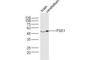 Lane 1: Mouse Brain lysates Lane 2: Mouse Cerebellum lysates probed with FSD1 Polyclonal Antibody, Unconjugated  at 1:300 dilution and 4˚C overnight incubation. (FSD1 抗体  (AA 421-496))