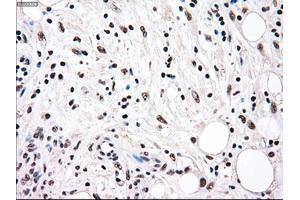 Immunohistochemical staining of paraffin-embedded colon tissue using anti-RAD9Amouse monoclonal antibody. (RAD9A 抗体)
