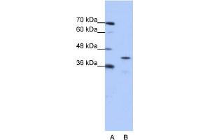 WB Suggested Anti-CPEB2 Antibody Titration:  0. (CPEB2 抗体  (Middle Region))