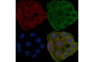 ABIN7094432 and ABIN7098480 staining Hela cells(24h of starvation treatment) by IF/ICC.