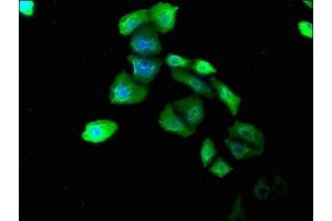 Immunofluorescence staining of Hela cells with ABIN7139783 at 1:180, counter-stained with DAPI. (COL6A1 抗体  (AA 64-80))