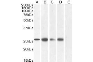 GJB2 抗体  (C-Term)