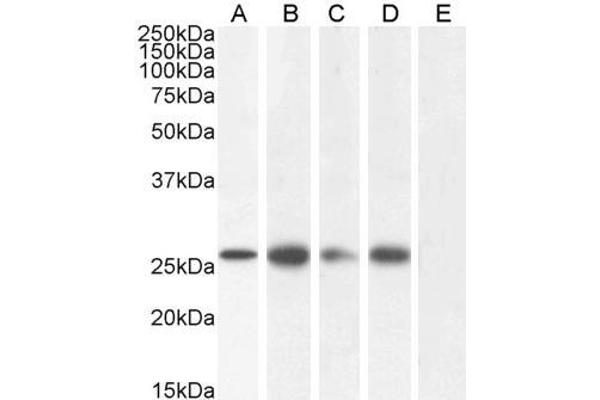 GJB2 抗体  (C-Term)