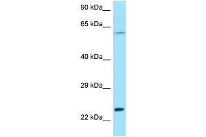 WB Suggested Anti-Rac2 Antibody Titration: 1. (RAC2 抗体  (C-Term))