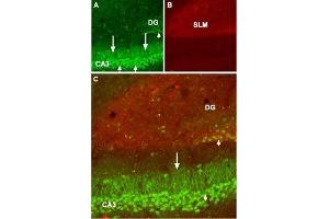 Expression of GABA(B) receptor 1 in mouse hippocampus - Immunohistochemical staining of mouse hippocampus frozen sections using Anti-GABA(B) R1 (extracellular) Antibody (ABIN7043195, ABIN7044319 and ABIN7044320), (1:100). (GABBR1 抗体  (Extracellular))