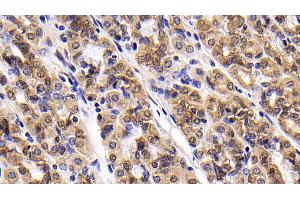 Detection of Surv in Human Stomach Tissue using Monoclonal Antibody to Survivin (Surv)
