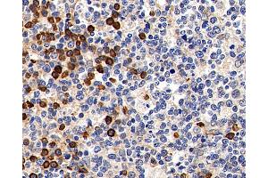 Immunohistochemistry analysis of paraffin-embedded Human tonsil using Cyclin B1 Polyclonal Antibody at dilution of 1:300. (Cyclin B1 抗体)