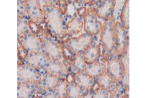IHC-P analysis of Kidney tissue, with DAB staining.