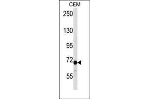 Western blot analysis of Dishevelled-2 / DVL2 Antibody (C-term) in CEM cell line lysates (35ug/lane).